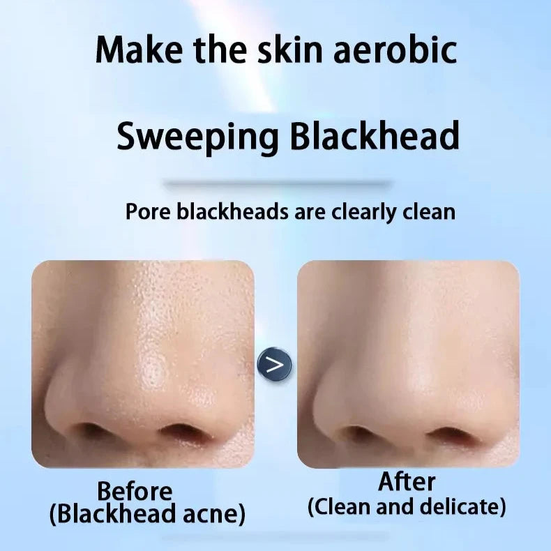 Visualized 50X Blackhead Absorber