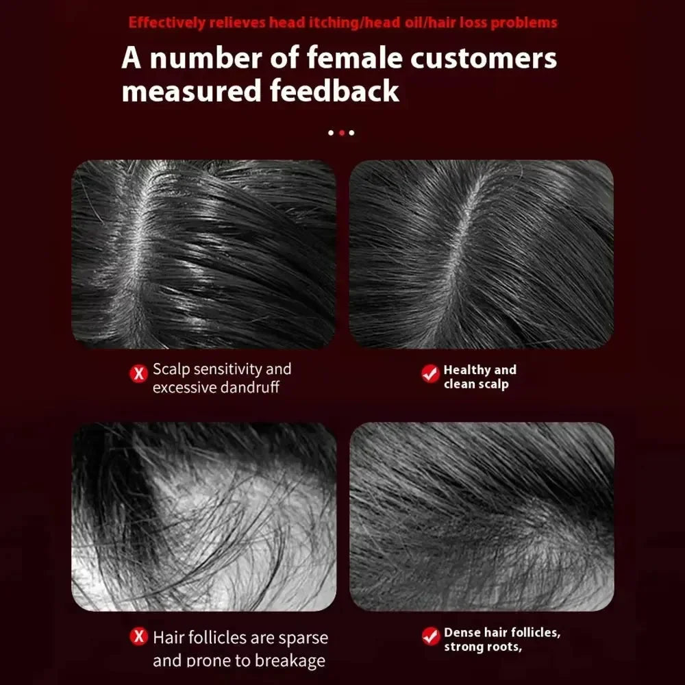 Growth Genesis Red Light Therapy Massage Comb - Bear Hugs