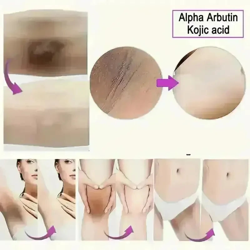 MELAO Skin Whitening Cream - Bear Hugs