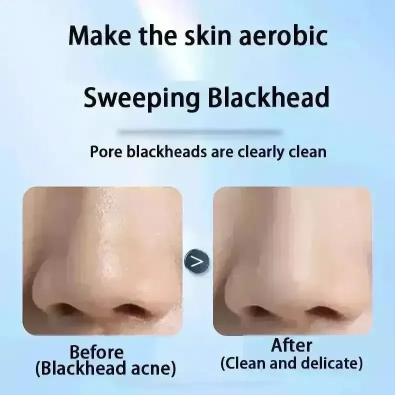 Visualized 50X Blackhead Absorber - Bear Hugs
