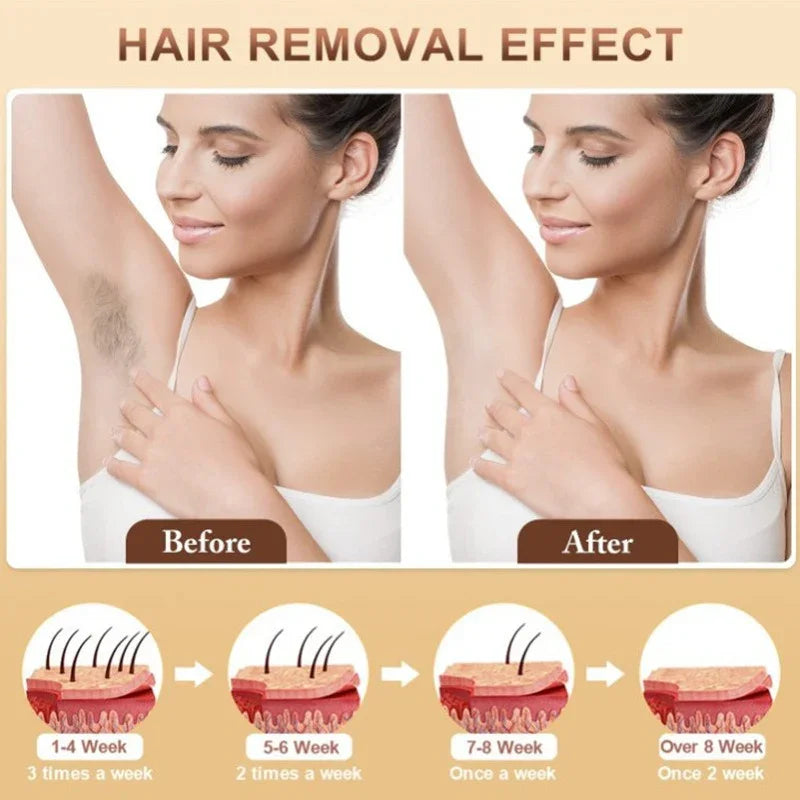 Glacia Frost Glide Laser Hair Removal Device