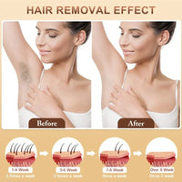 Glacia Frost Glide Laser Hair Removal Device