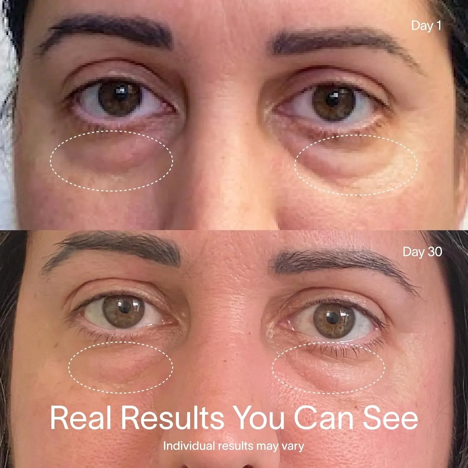 SW Red Light Therapy Eye Mask