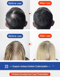 AuraRoot Hair Rejuvenation Cap