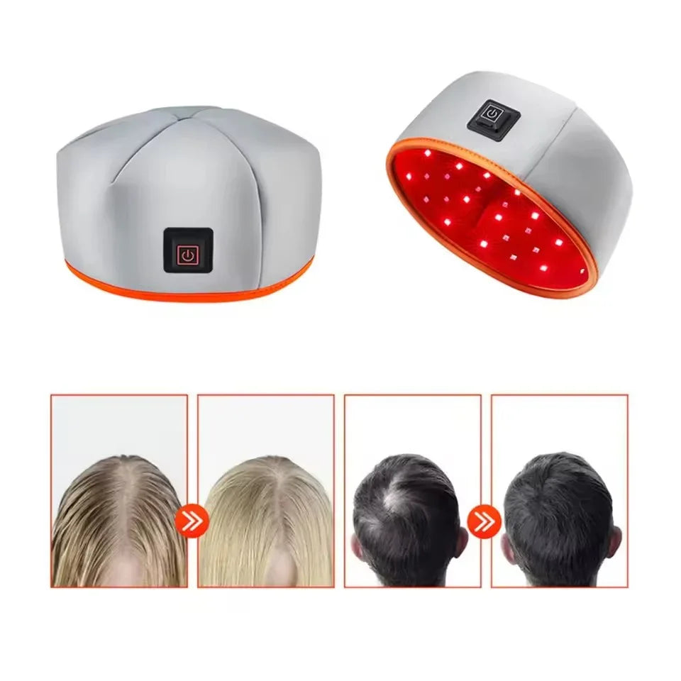 AuraRoot Hair Rejuvenation Cap