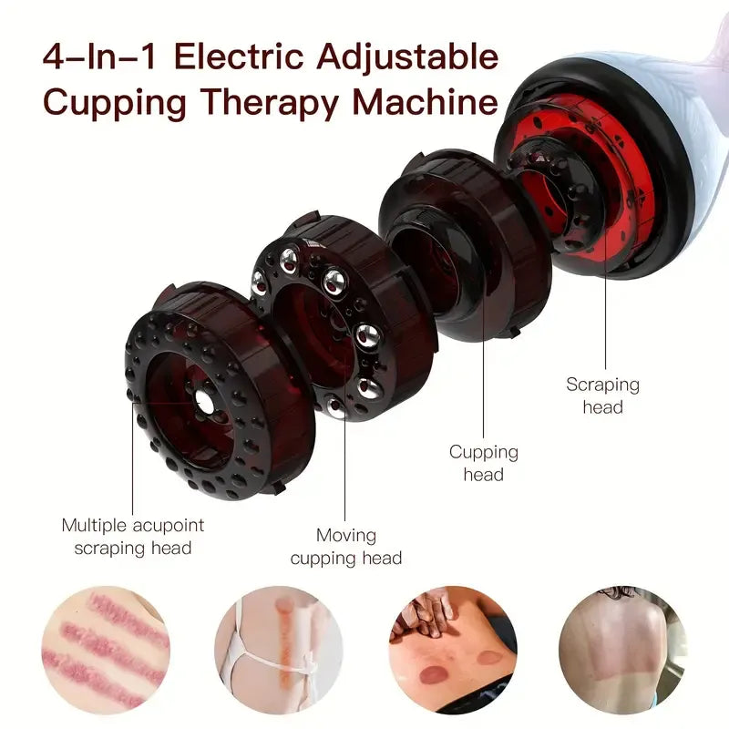 KTS Smart Cupping Massager