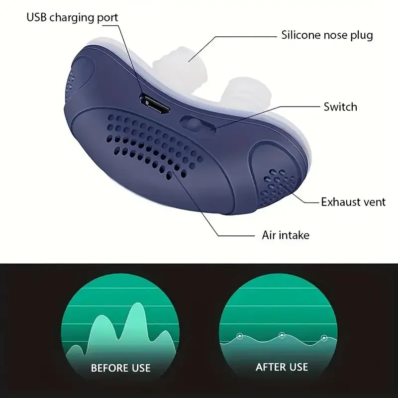 QC Magic Anti Snoring Device